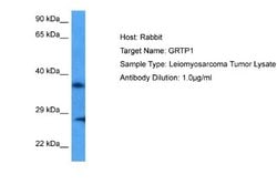 GRTP1 Antibody, Novus Biologicals 100 &mu;L; Unconjugated:Antibodies, Polyclonal